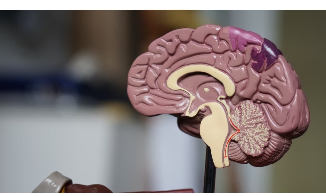 Aneurisma Otak, Penyakit Tidak Mematikan, Tapi Penyebab Utama Kecacatan Otak
