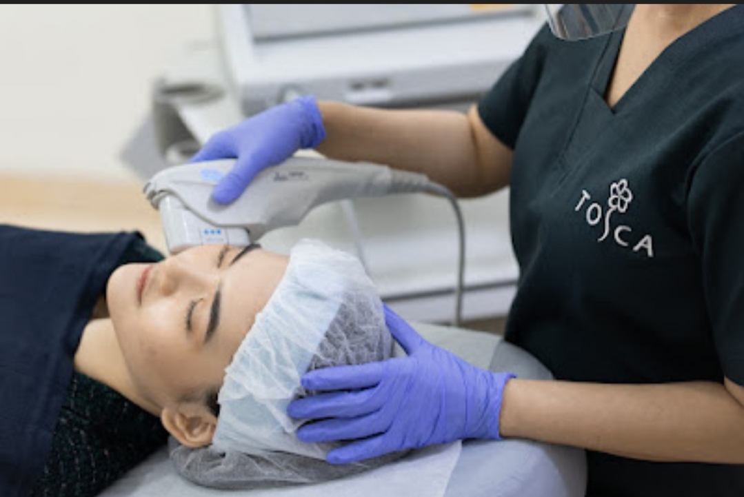 Tosca Aesthetic Clinic Perkenalkan Ultherapy Prime Teknologi Terbaru Face Lifting & Tightening Non-bedah